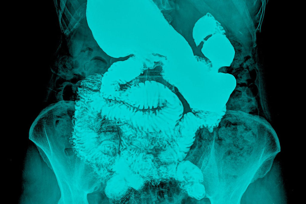 The Power of the Gut-Brain Connection